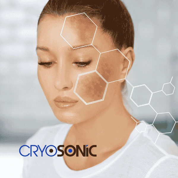 Are you looking for age spot removal treatment? Contact Cryosonic today in Worcester